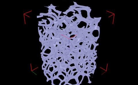 X-ray Computed Tomography of Reticulated Vitreous Carbon Electrodes