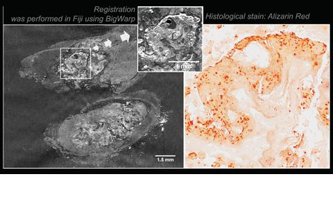 Tumour response to novel drugs