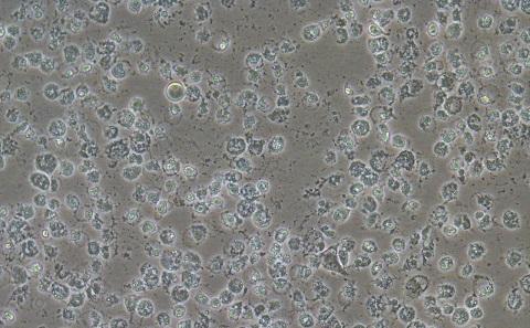 Infection of McCoy cells with C. trachomatis (LGV) 