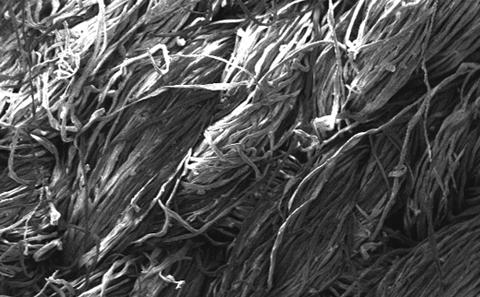 Lost in Lace Project