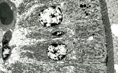 Transmission Electron Microscopy Course