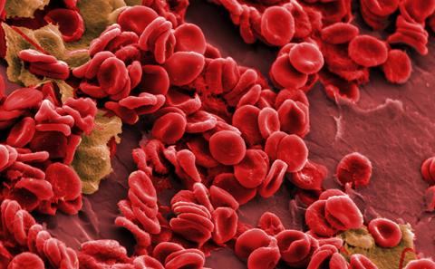 SEM image of blood cells