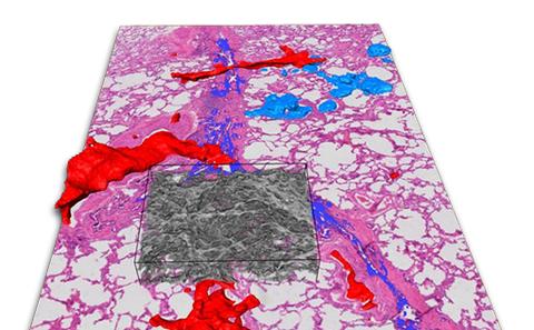 Biomedical Imaging Unit and µ-VIS joint one-day meeting