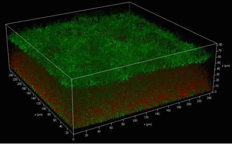 A Haemophilus influenzae biofilm