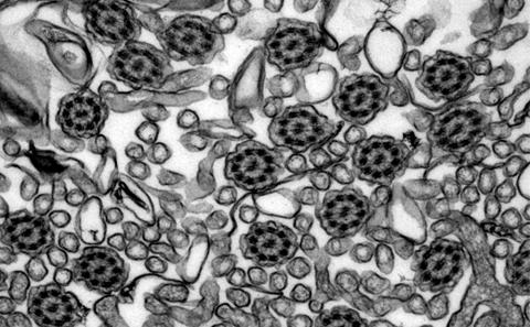 TEM image of cilia from PCD patient