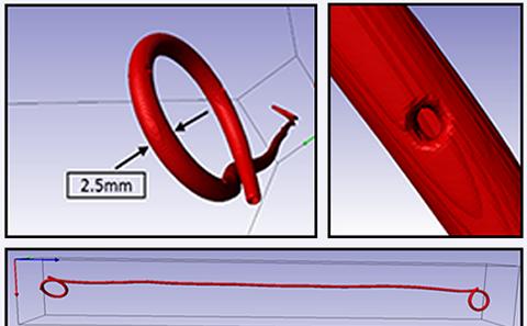 Fluid dynamics study on the mechanism of encrustation in ureteric stents