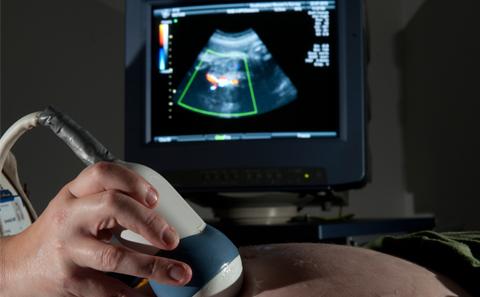 Ultrasound scan