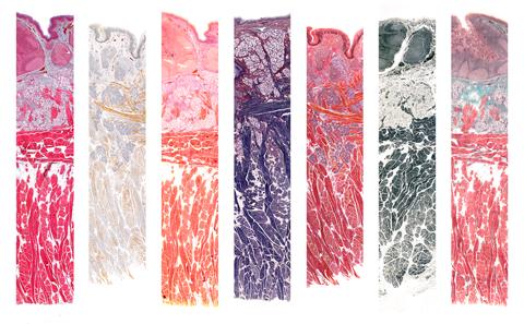 sections of human tongue