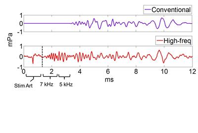 Using a novel technique for enhancing high-frequency components