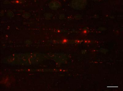 Residual contamination in endoscope