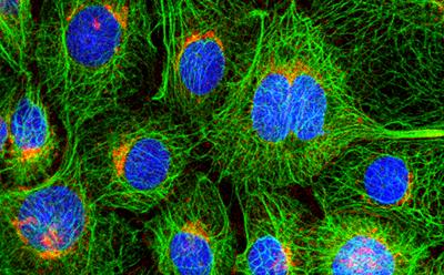 riple labelling experiment performed and imaged during ALMC course