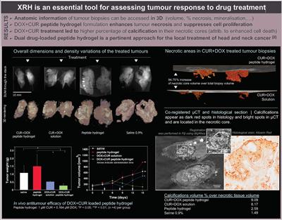 μCT-based characterisation of 3D printed pharmaceutical dosage forms 
