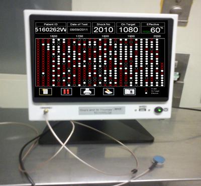 The Lithocheck screen