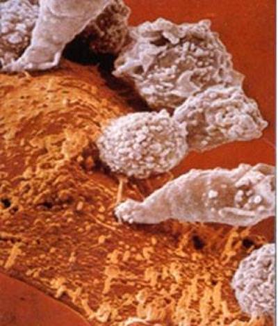 Cytotoxic T Cells (CTL)