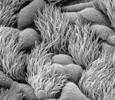 Image of ciliated airway cells