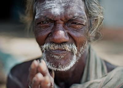 Multimorbidity is a trend linked to the ageing population and the burden of non-communicable disease