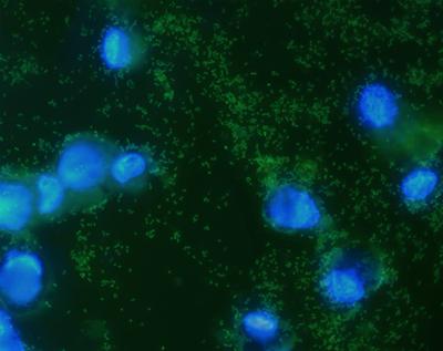 Respiratory tract pathogen infecting macrophages
