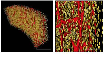 Duck tibiotarsus imaged at TOMCAT - Scale bar 200μm & 50μm