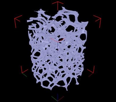 CT scan of a cylindrical RVC sample grade 20 ppi. Diameter 5 mm. The structure of the porous foam-like material can be appreciated.