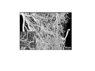 MicroCT images  showing 3D architecture of the microvascular bed of the soleus muscle from a mouse. Inset shows resolution of 5 µm capillary