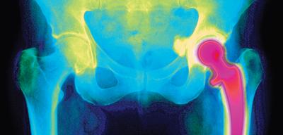 An insight into the mechanics of the human body