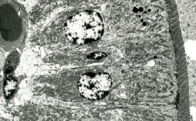 Transmission Electron Microscopy Course