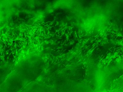 Bacteria and biofilm within a wound model