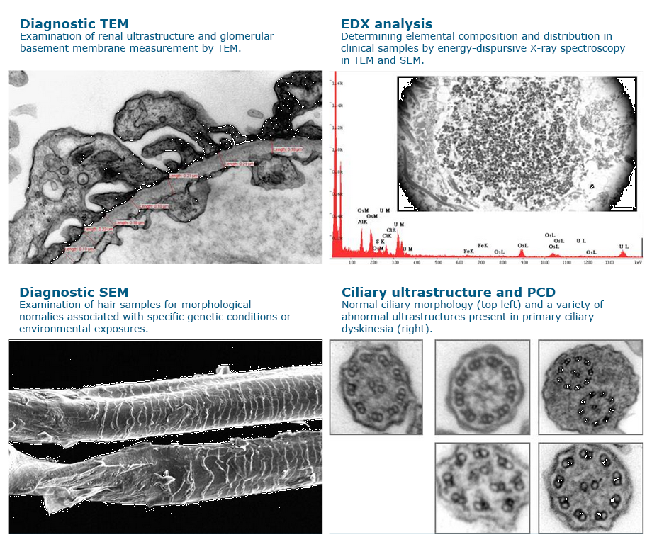 BIU's NHS diagnostic services