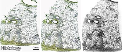 Image matching of μCT and histological section stained with Movat’s Pentachrome.