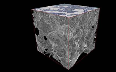 Microfocus CT scan of a lung