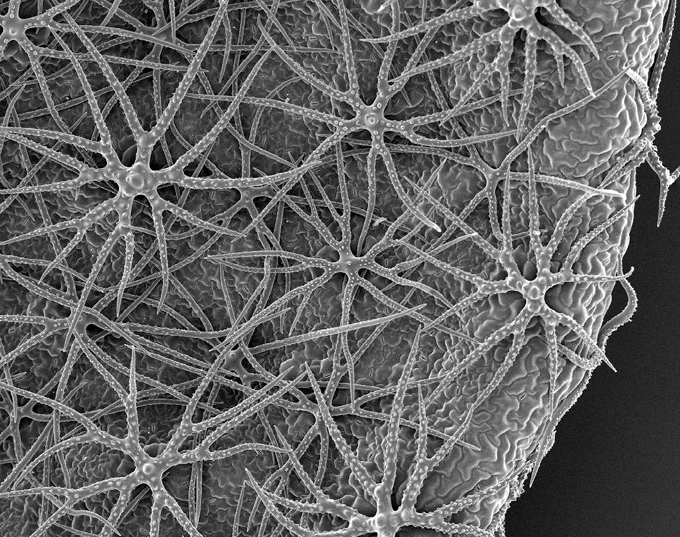 Stellate trichromes - Rachael Graham