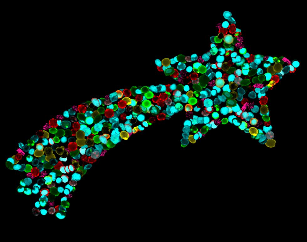 ImageStream Bone Marrow Christmas Star - Agnieszka Janeczek