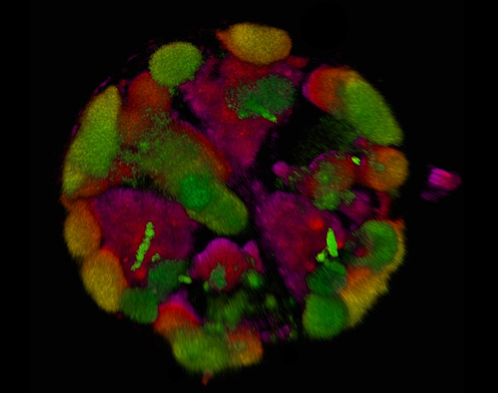 Planktonic ball - Jacqui Nimmo 