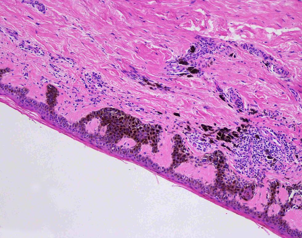 Animals in the skin - Charlie Tilley