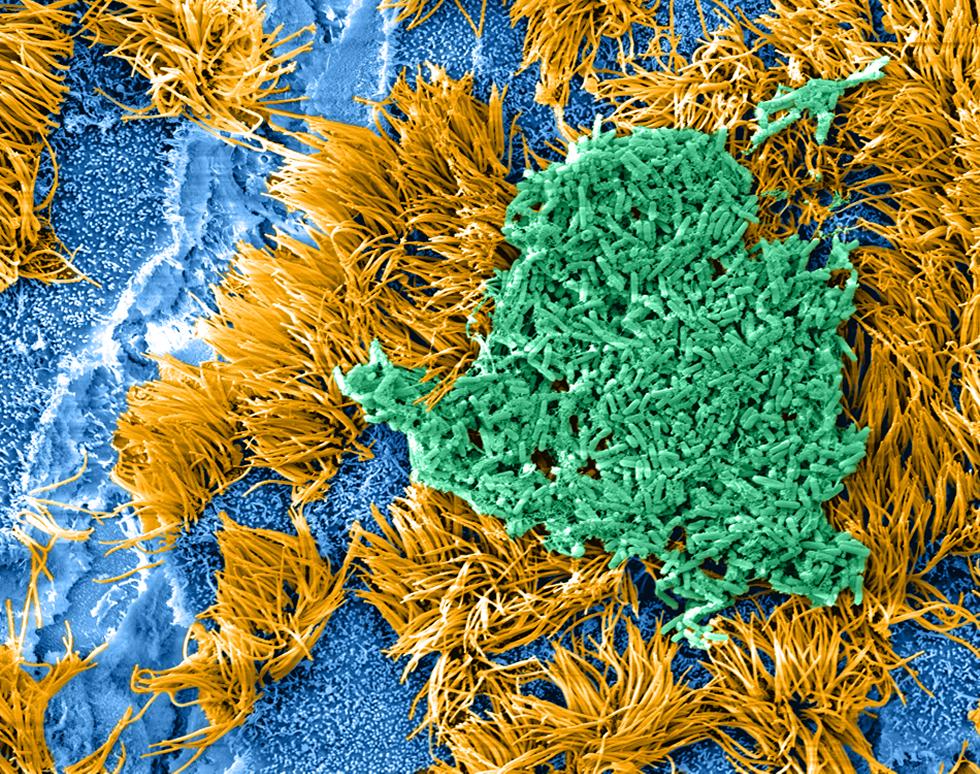 Pseudomonas aeruginosa on ciliated human epithelial cells grown at an air liquid interface - Bavik Barochia