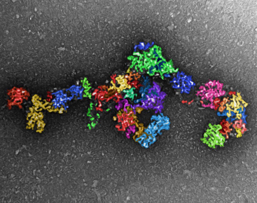 Decorated protein - Jacqui Nimmo
