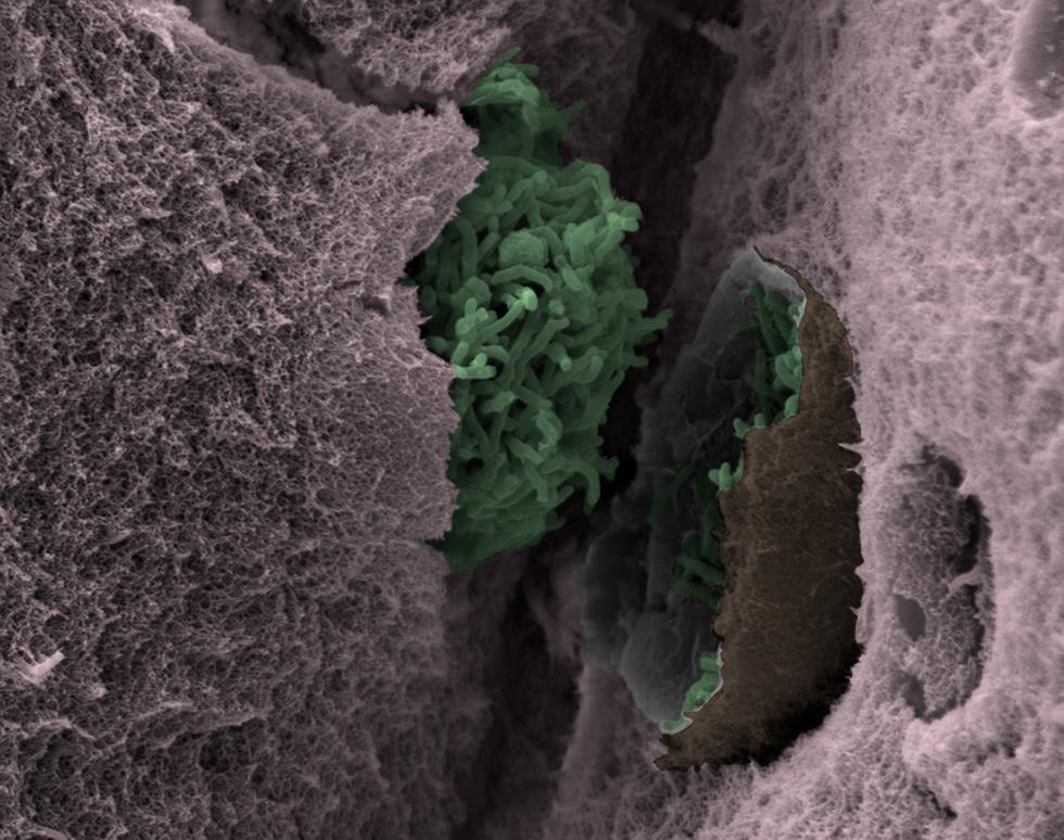 Bad egg - Elena Konstantinopoulou