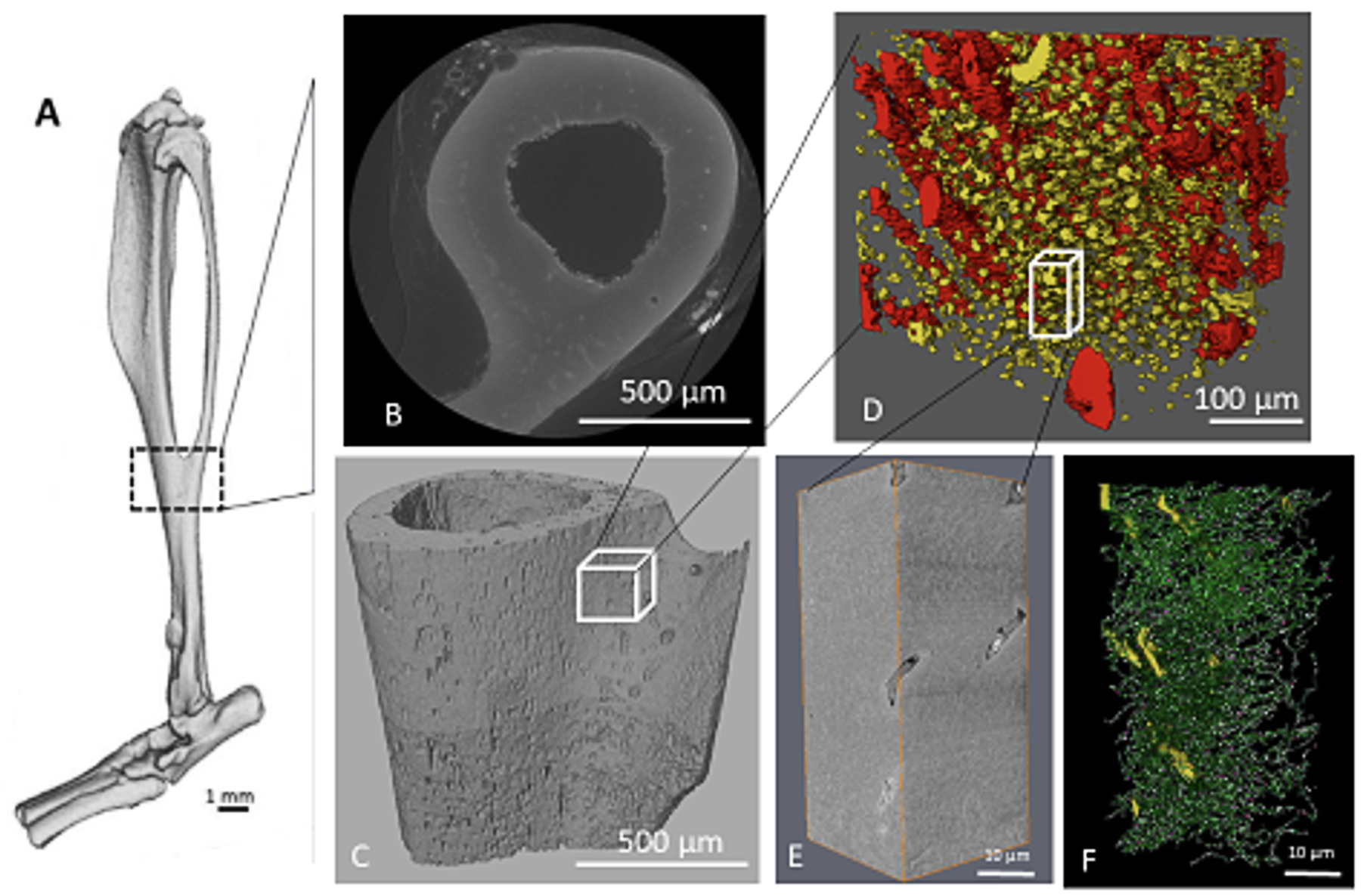 Summary of the correlative µCT & SBF SEM imaging workflow