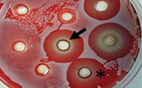 Inhibition of bacterial growth