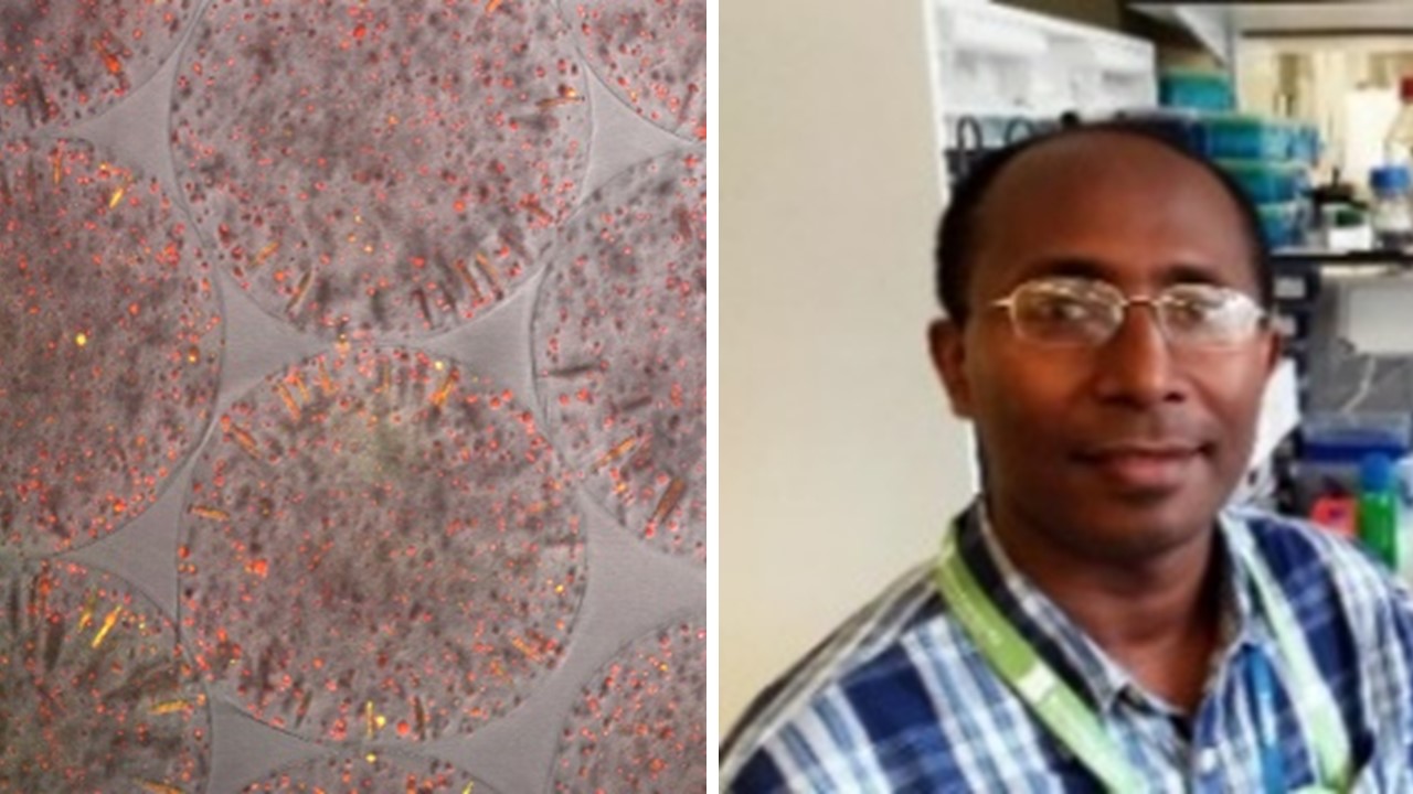 Left: Cells (red) & degraded collagen (yellow).     Right: Liku Tezera