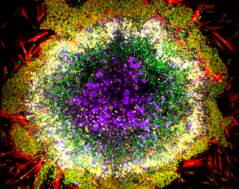 Cellular supernova - Benjamin Sharpe