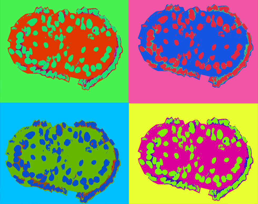 Airway epithelial spheroid - Cosma Mirella Spalluto