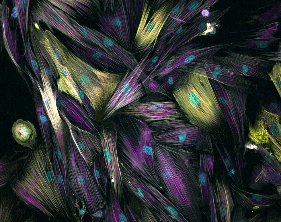 Fibrous Fibroblasts - Benjamin Sharpe