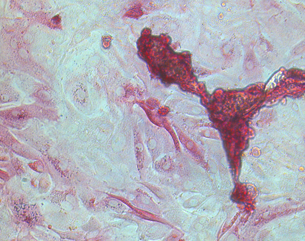 Breathing Life into the Lungs - Lareb Dean