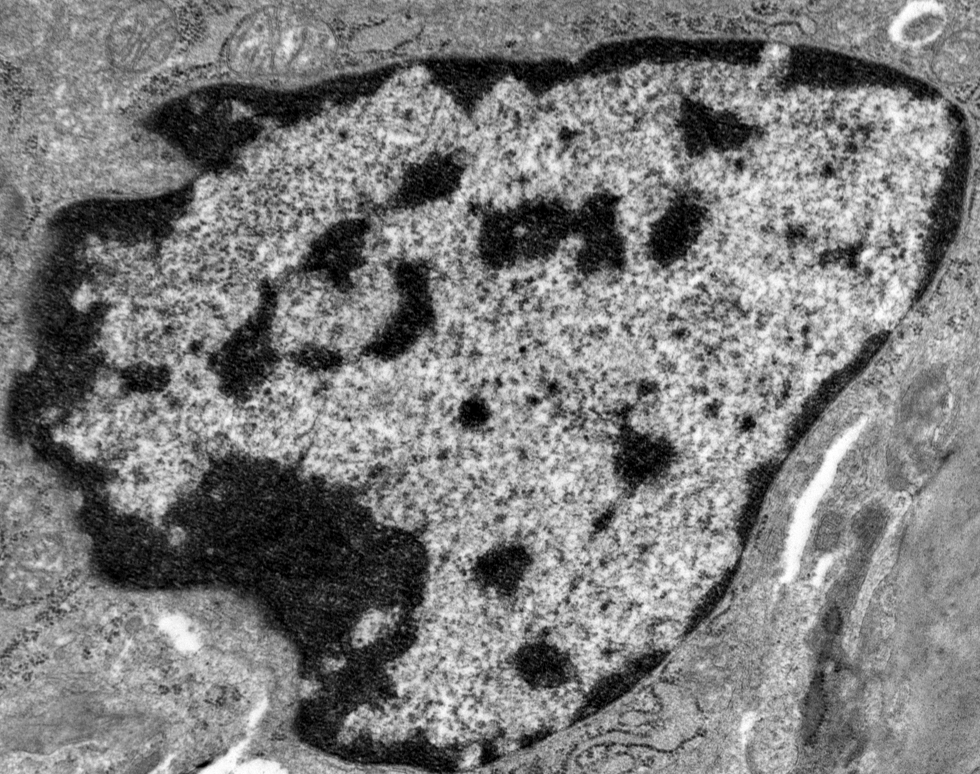 Angry Fish - Mat Lawson