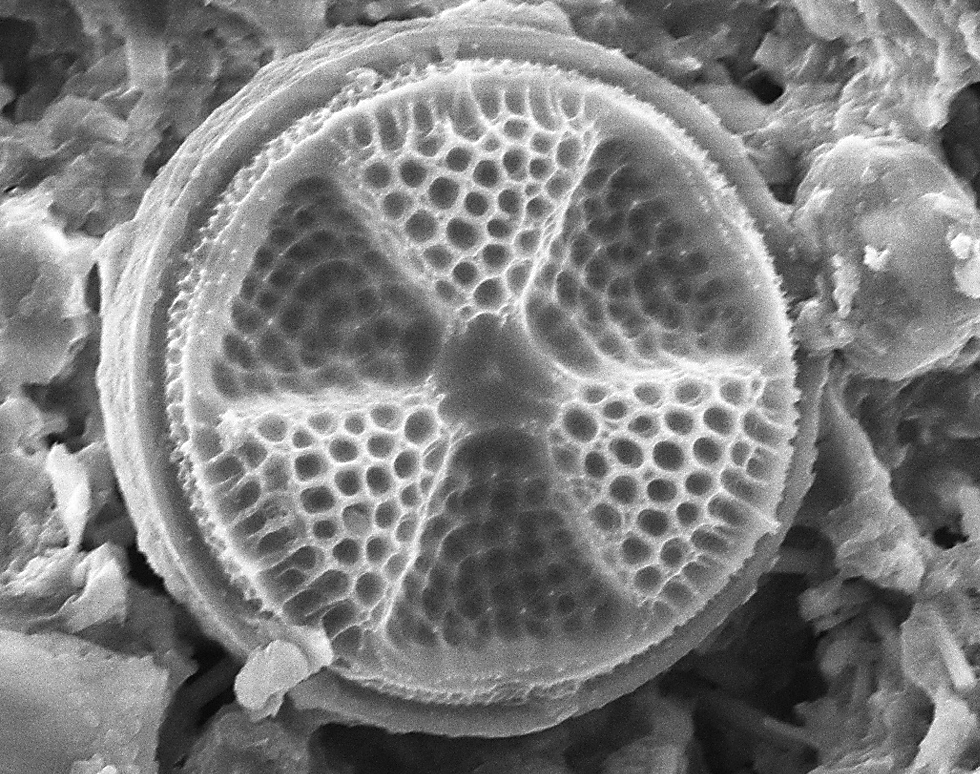 Actinoptychus_Diatom - Nichola Strandberg