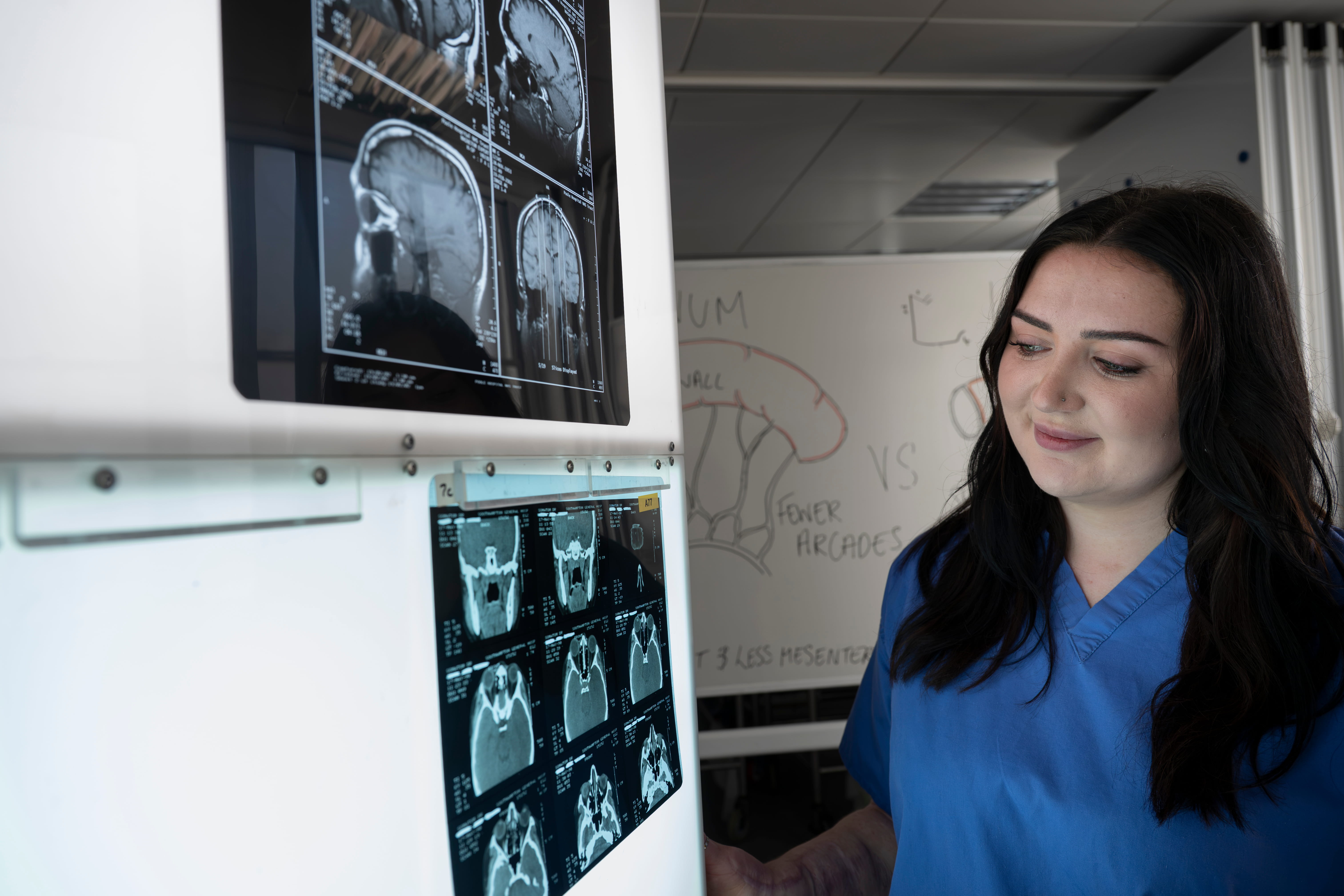 Healthcare student reviewing brain scan images on a medical display in a clinical learning environment.