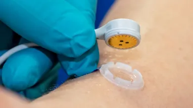 Close up of a skin sensor being placed on a patient's arm