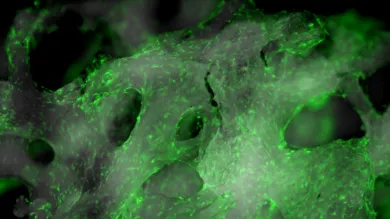 Microscope image of fluorescent cells on trabeculae
