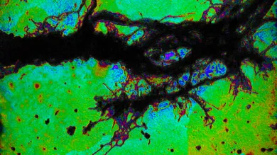 X-ray microscope image of a bundle of dendrites grown from a mouse neuron. The magnification is higher than possible using visible light.